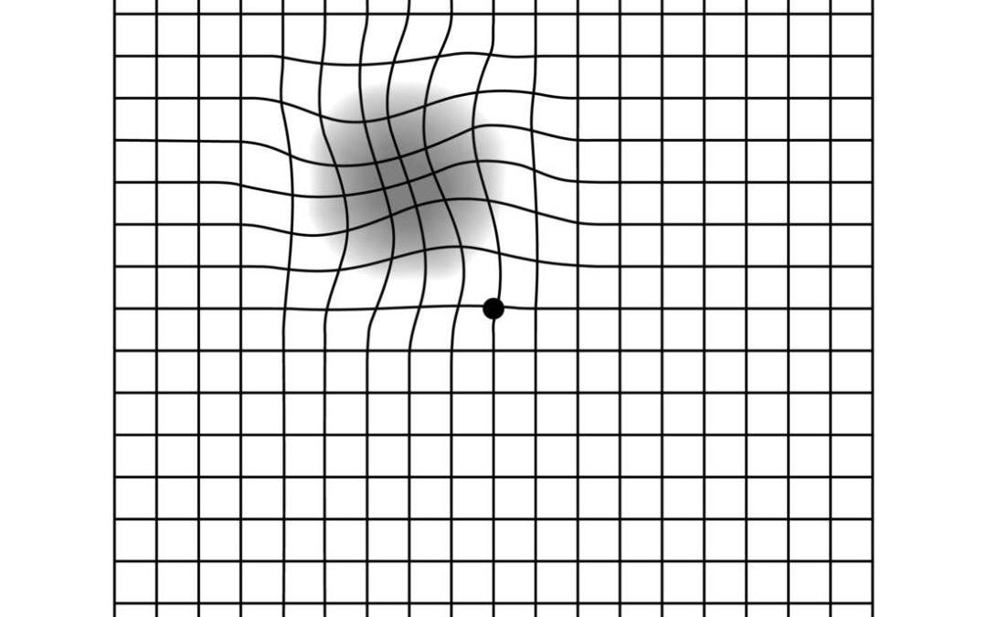 Age-Related Macular Degeneration: Protecting Your Central Vision