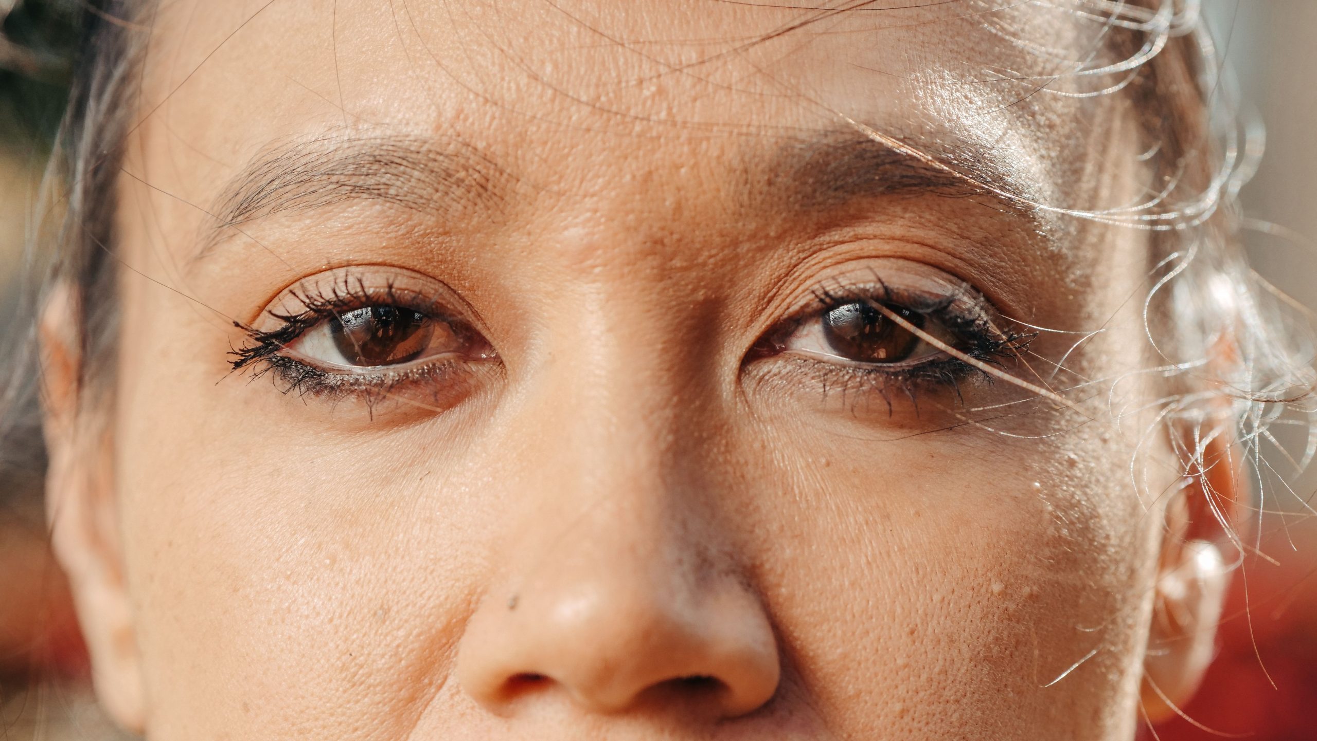understanding-blepharitis
